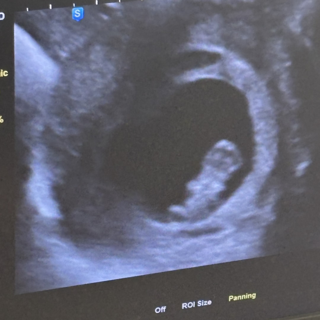 Photo shared by Iyona for their Babylist baby registry.