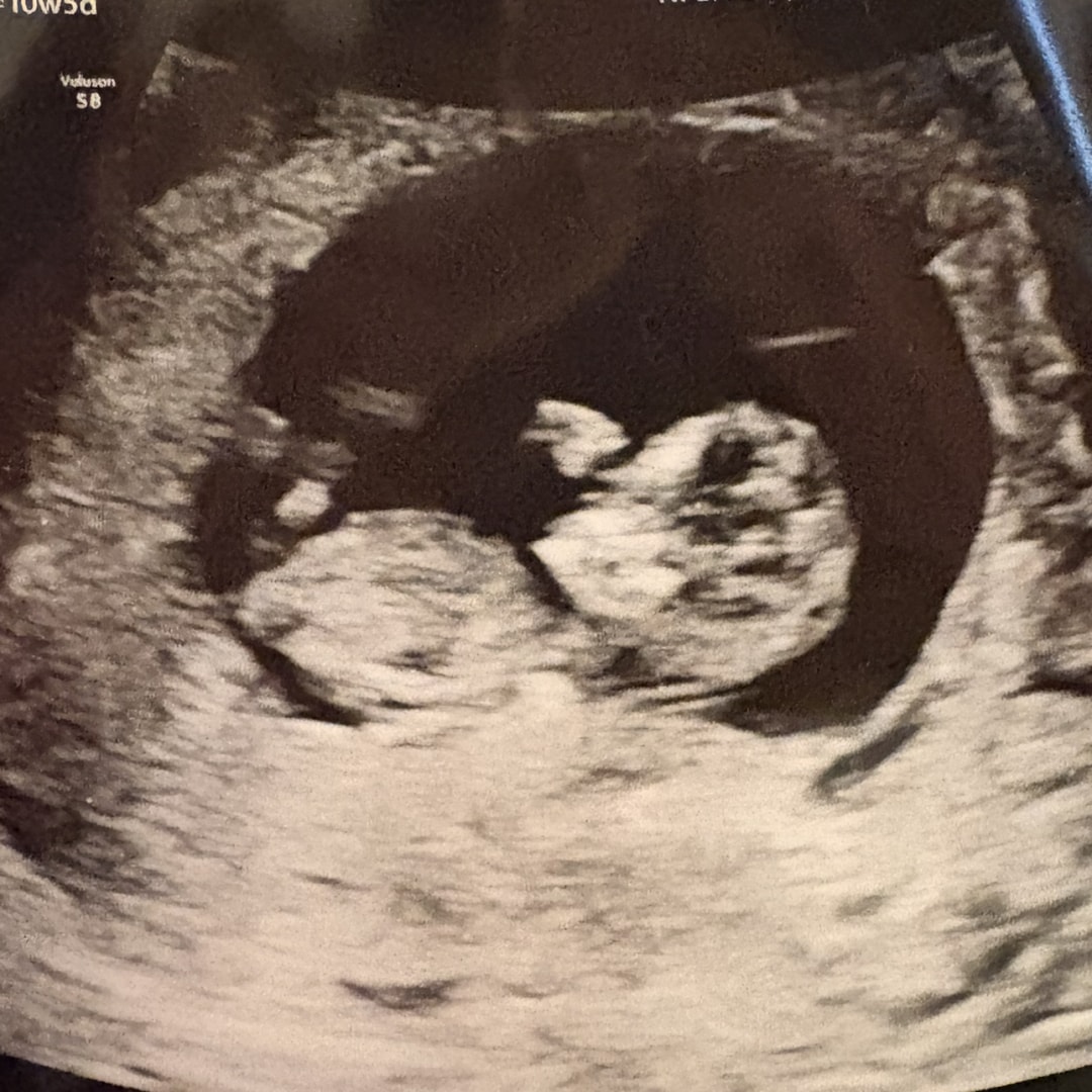 Photo shared by Morgan for their Babylist baby registry.