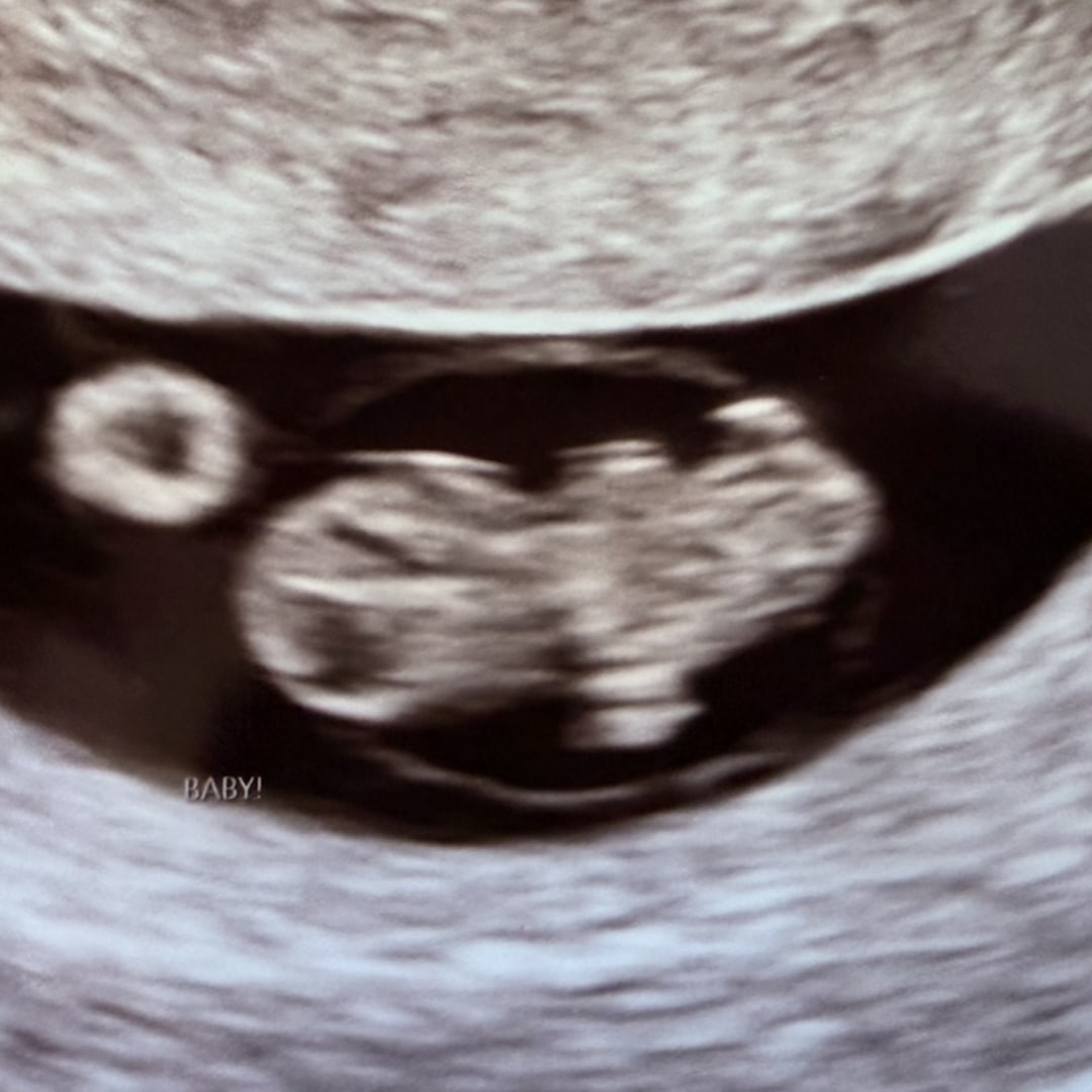 Photo shared by Cassidy for their Babylist baby registry.