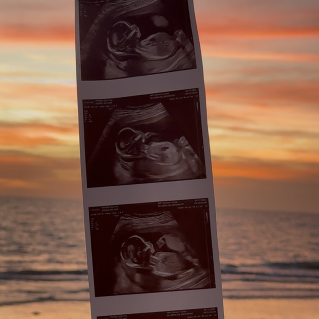 Photo shared by Melanie for their Babylist baby registry.