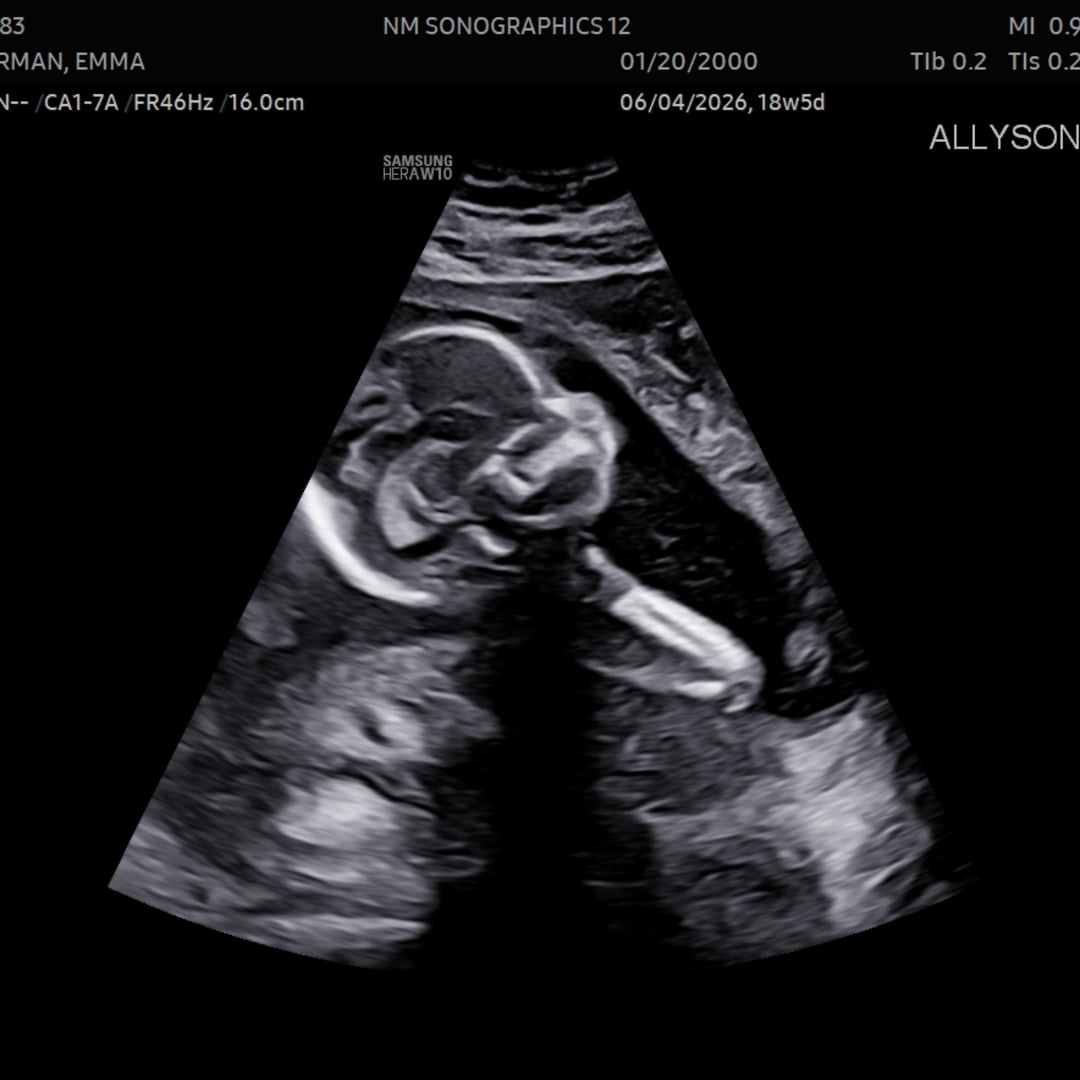 Photo shared by Emma for their Babylist baby registry.