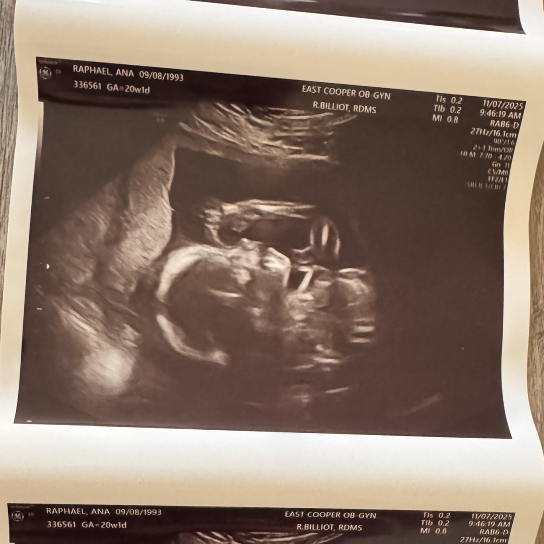 Photo shared by Ana for their Babylist baby registry.