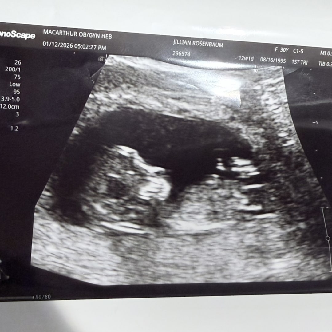 Photo shared by Jillian for their Babylist baby registry.