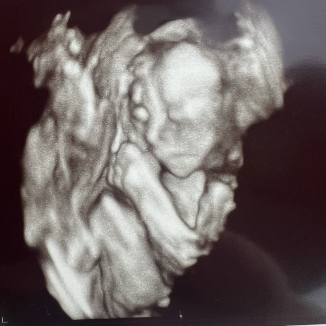 Photo shared by Taylor for their Babylist baby registry.