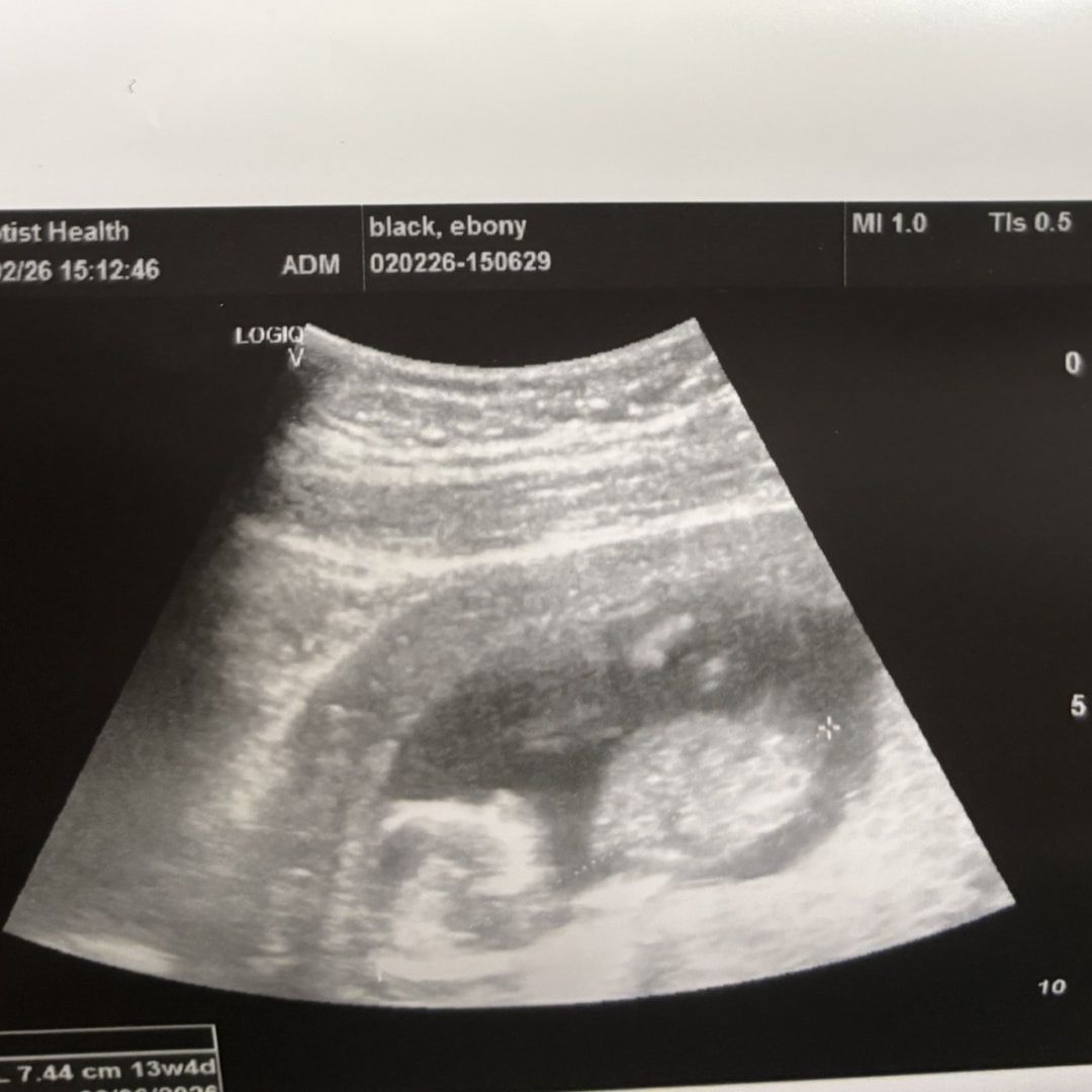 Photo shared by Ebony for their Babylist baby registry.