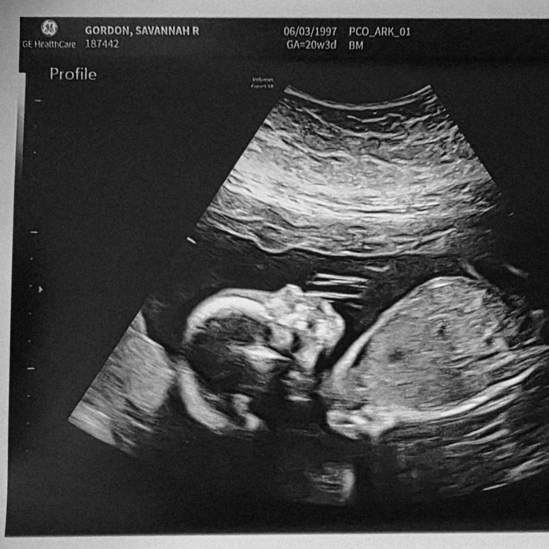 Photo shared by Savannah for their Babylist baby registry.