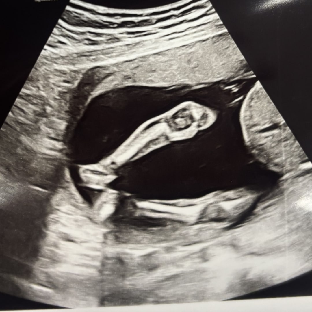 Photo shared by Gianna for their Babylist baby registry.