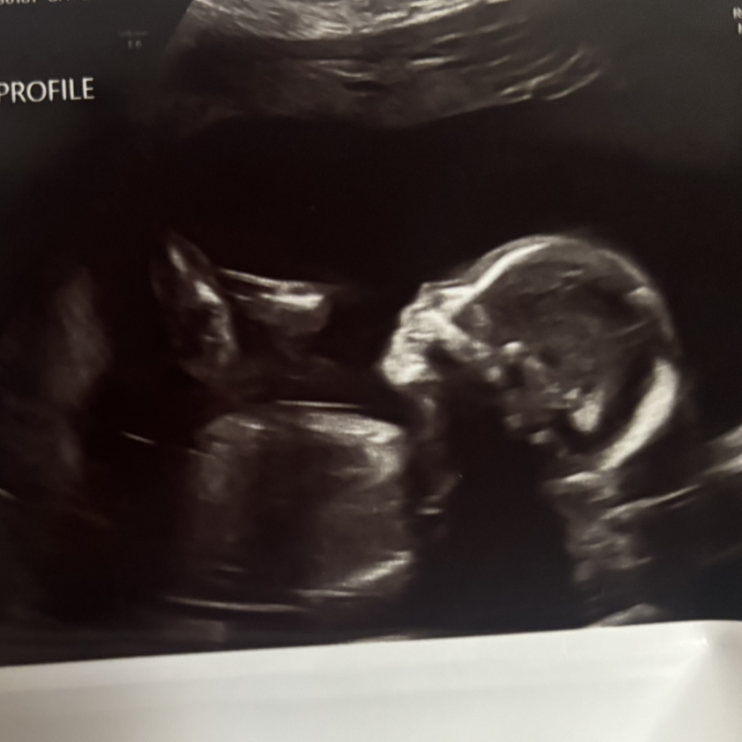 Photo shared by Mayra for their Babylist baby registry.