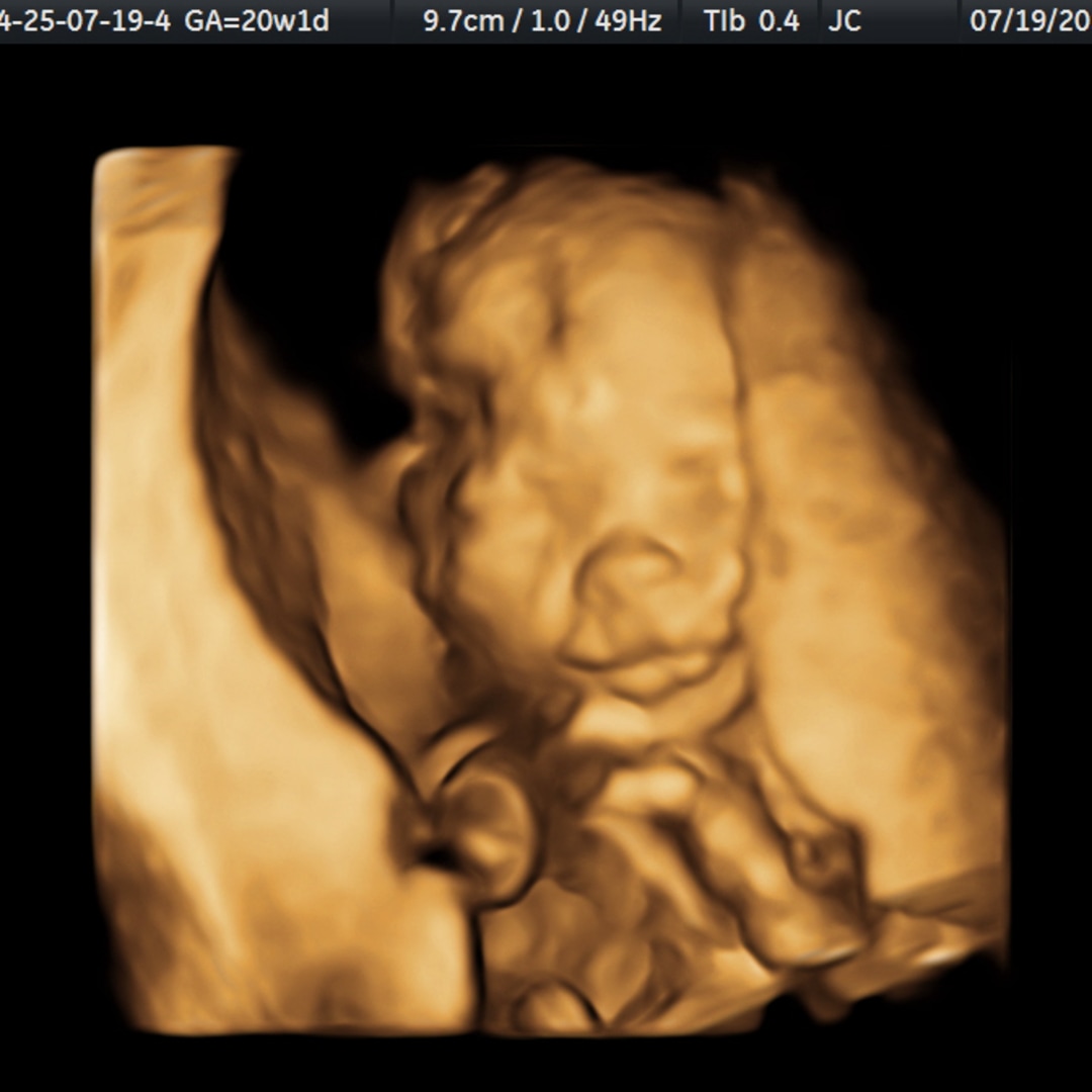 Photo shared by Amanda for their Babylist baby registry.