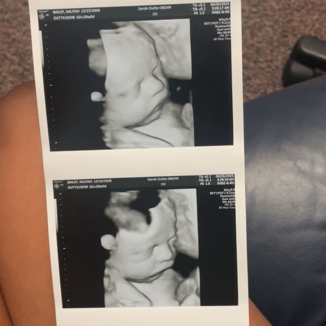 Photo shared by Aaliyah for their Babylist baby registry.