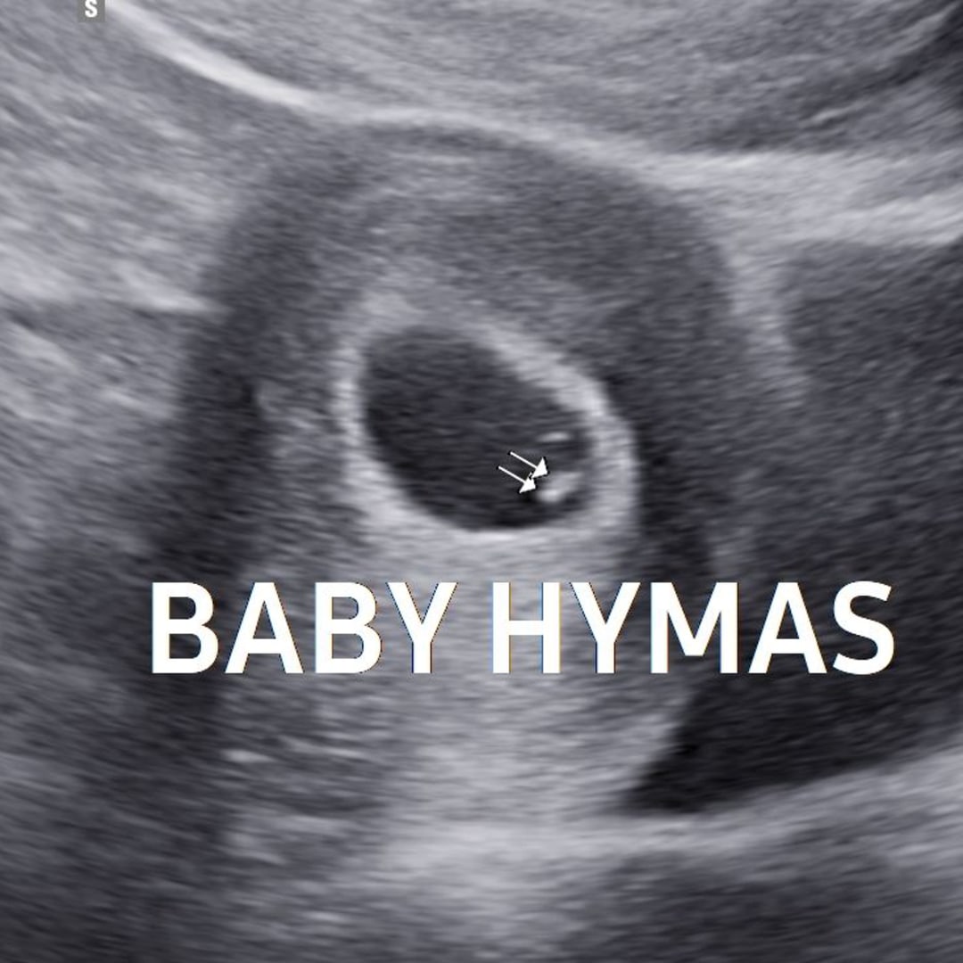 Photo shared by Allyson for their Babylist baby registry.