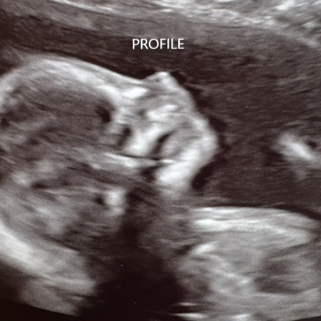 Photo shared by Kennedy for their Babylist baby registry.