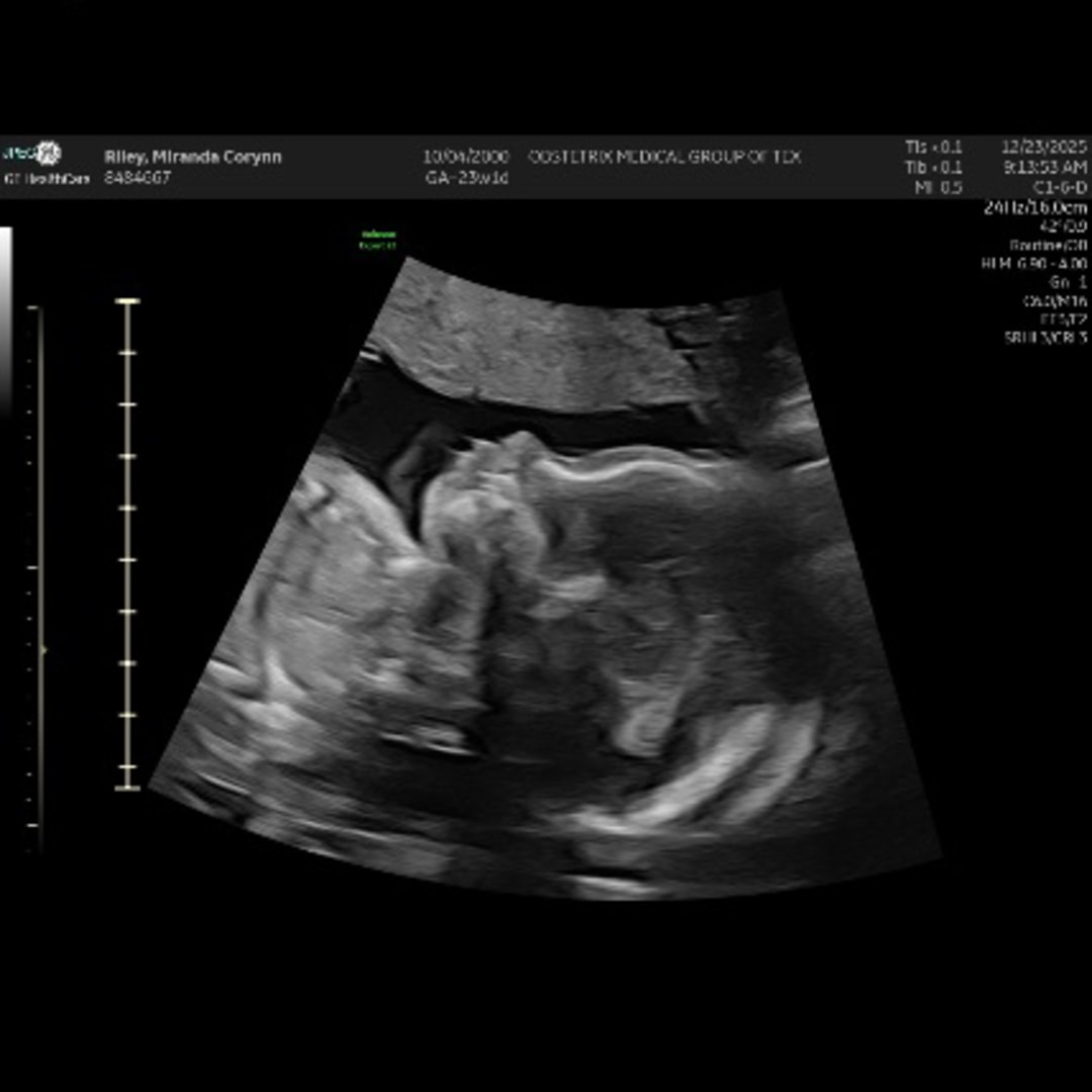 Photo shared by Corynn for their Babylist baby registry.