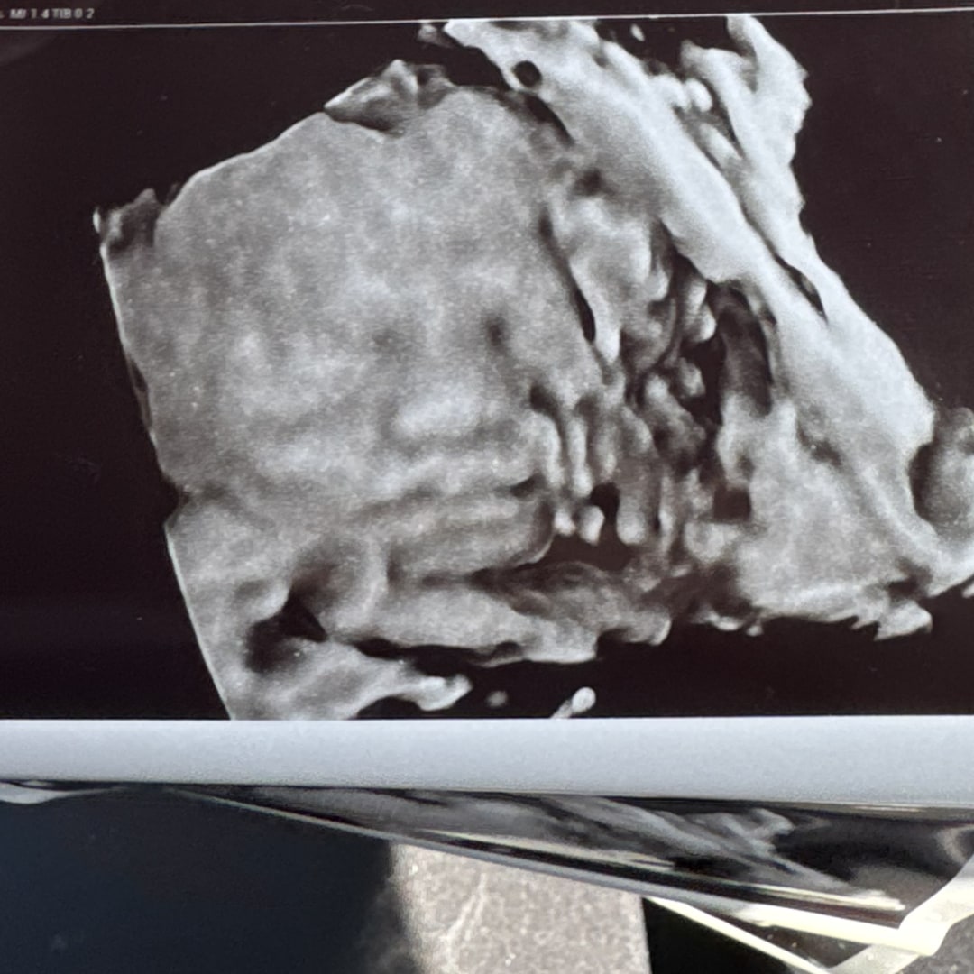 Photo shared by Mya for their Babylist baby registry.