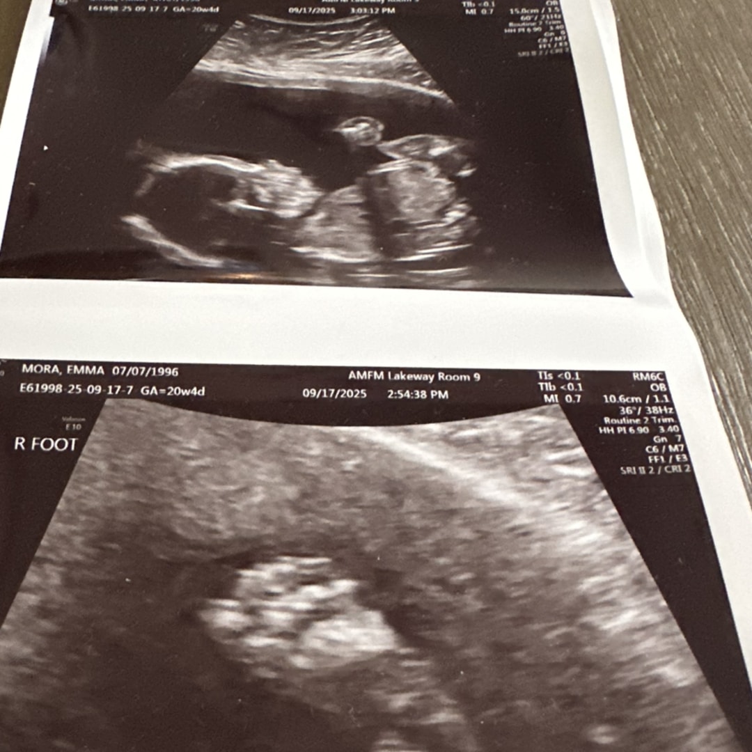 Photo shared by Emma for their Babylist baby registry.