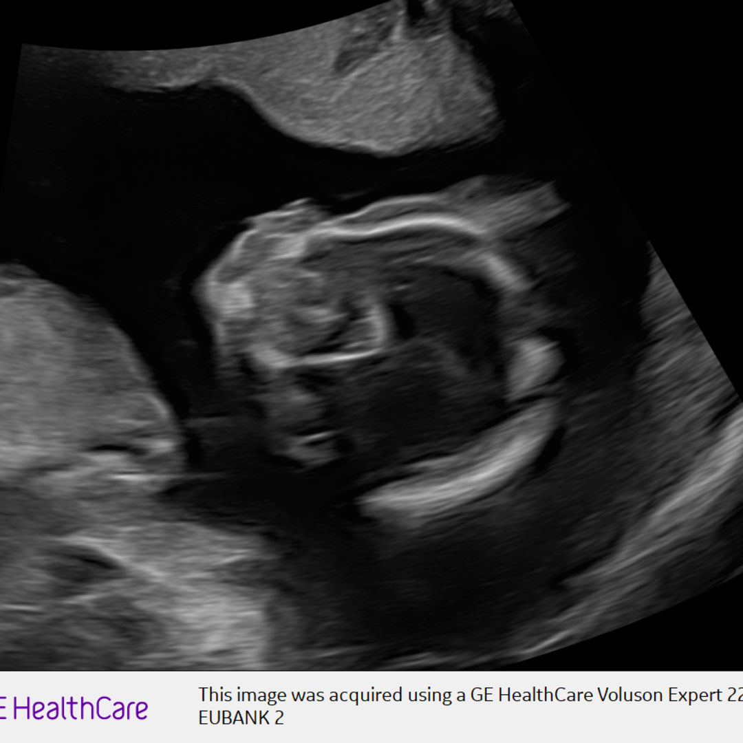 Photo shared by Danielle for their Babylist baby registry.