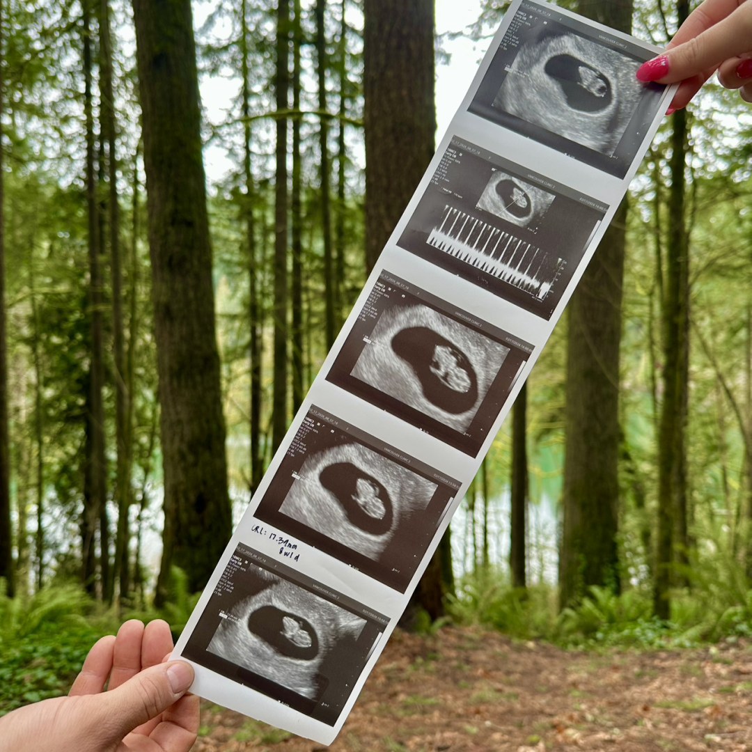 Photo shared by Laura for their Babylist baby registry.