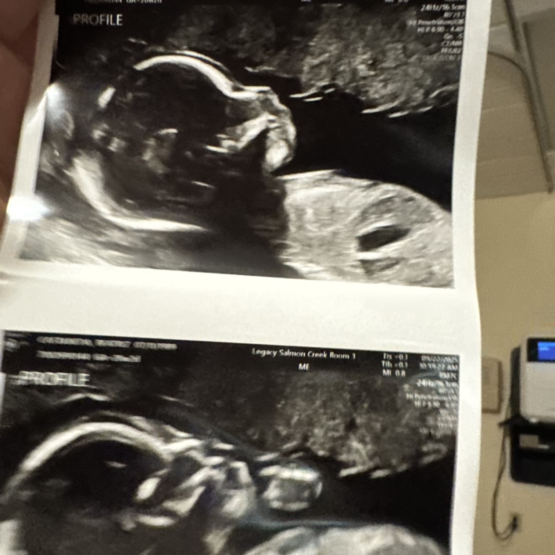 Photo shared by Beatriz for their Babylist baby registry.