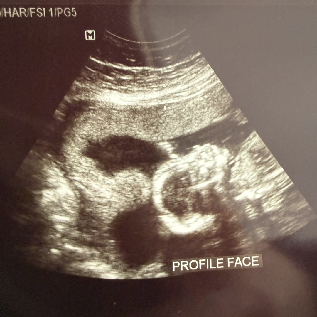 Photo shared by Morgan for their Babylist baby registry.