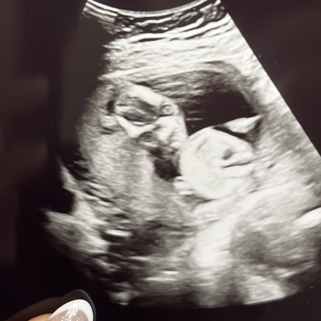Photo shared by Rachel for their Babylist baby registry.