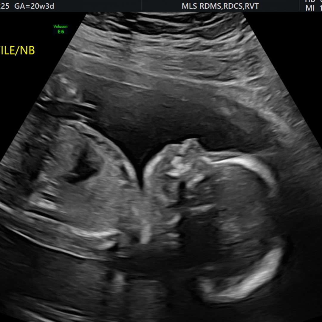 Photo shared by Elizabeth for their Babylist baby registry.