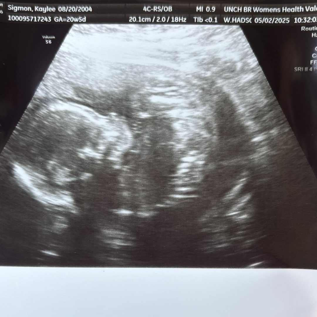 Photo shared by Kaylee for their Babylist baby registry.