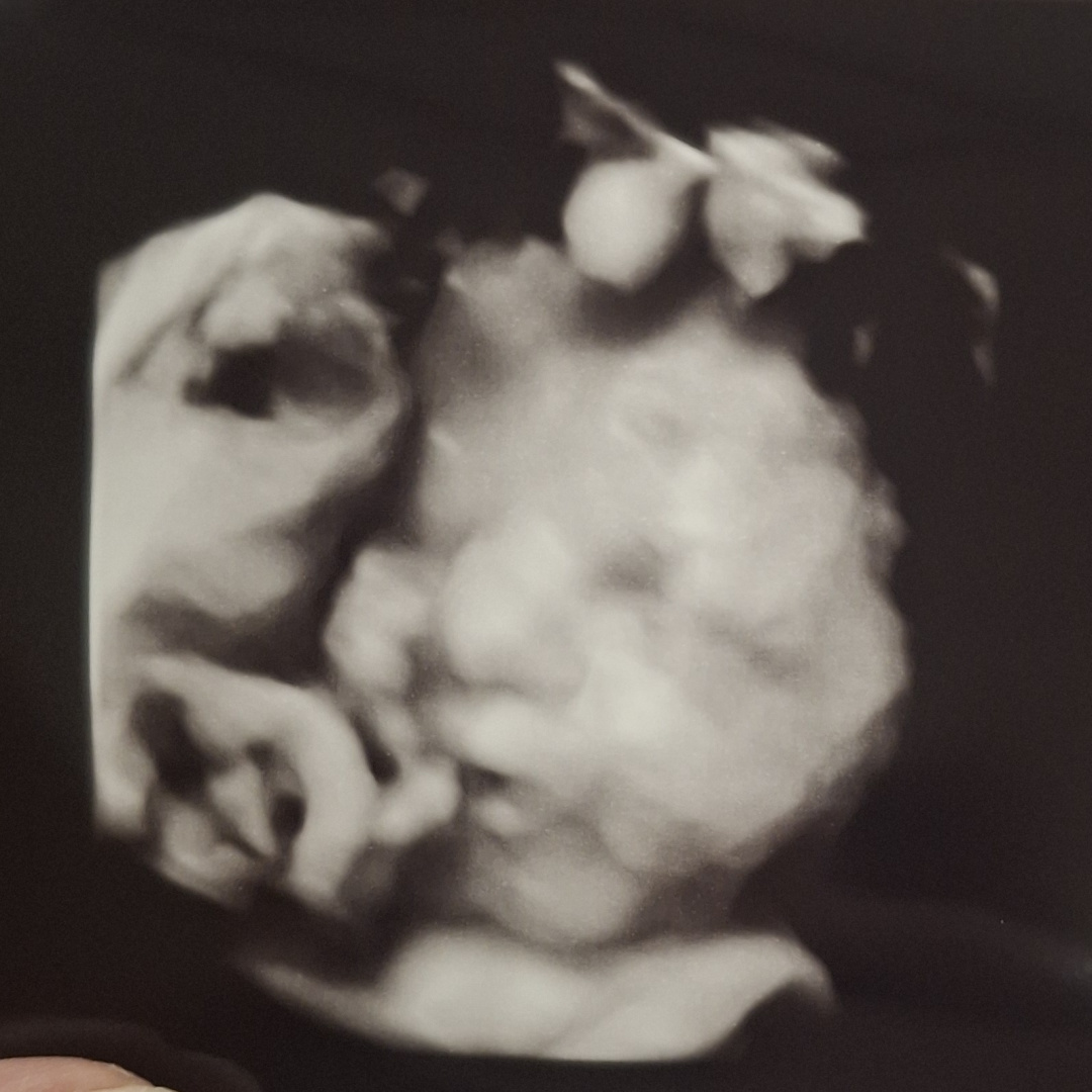 Photo shared by Diamond for their Babylist baby registry.