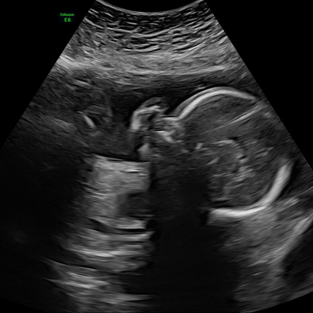 Photo shared by Lainey for their Babylist baby registry.