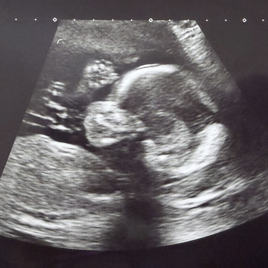 Photo shared by Bobbie for their Babylist baby registry.