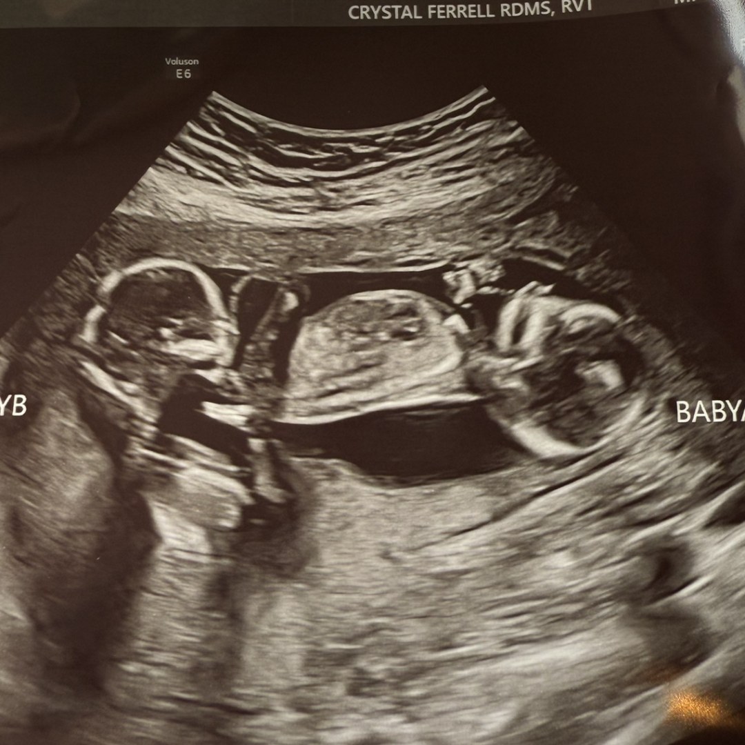 Photo shared by Diamond for their Babylist baby registry.