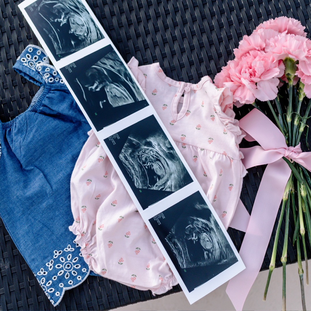Photo shared by Chelsea for their Babylist baby registry.
