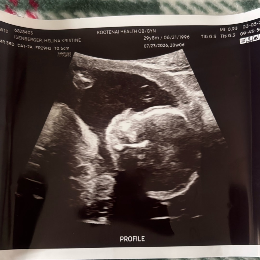 Photo shared by Helina for their Babylist baby registry.