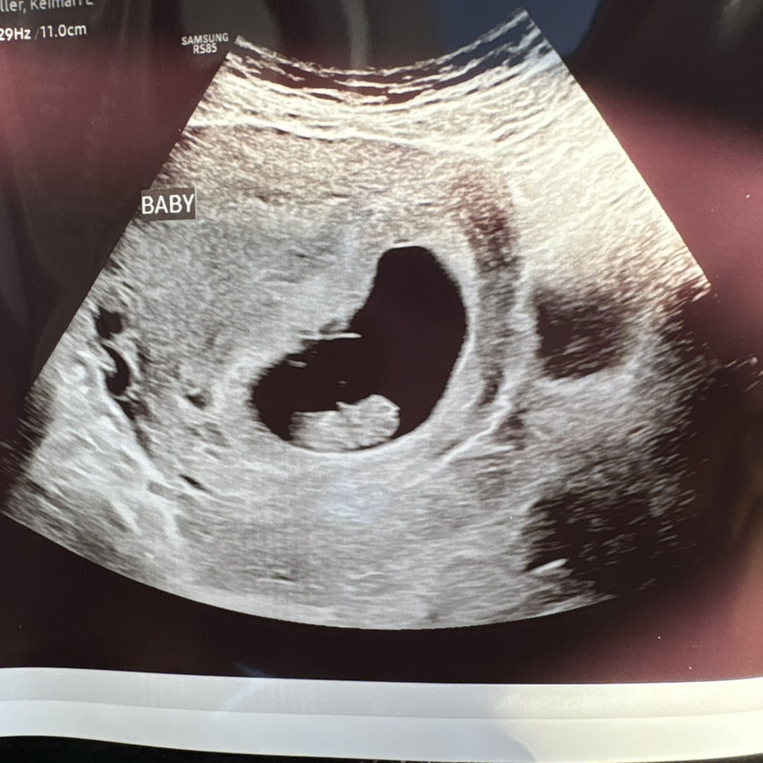 Photo shared by Keimari for their Babylist baby registry.