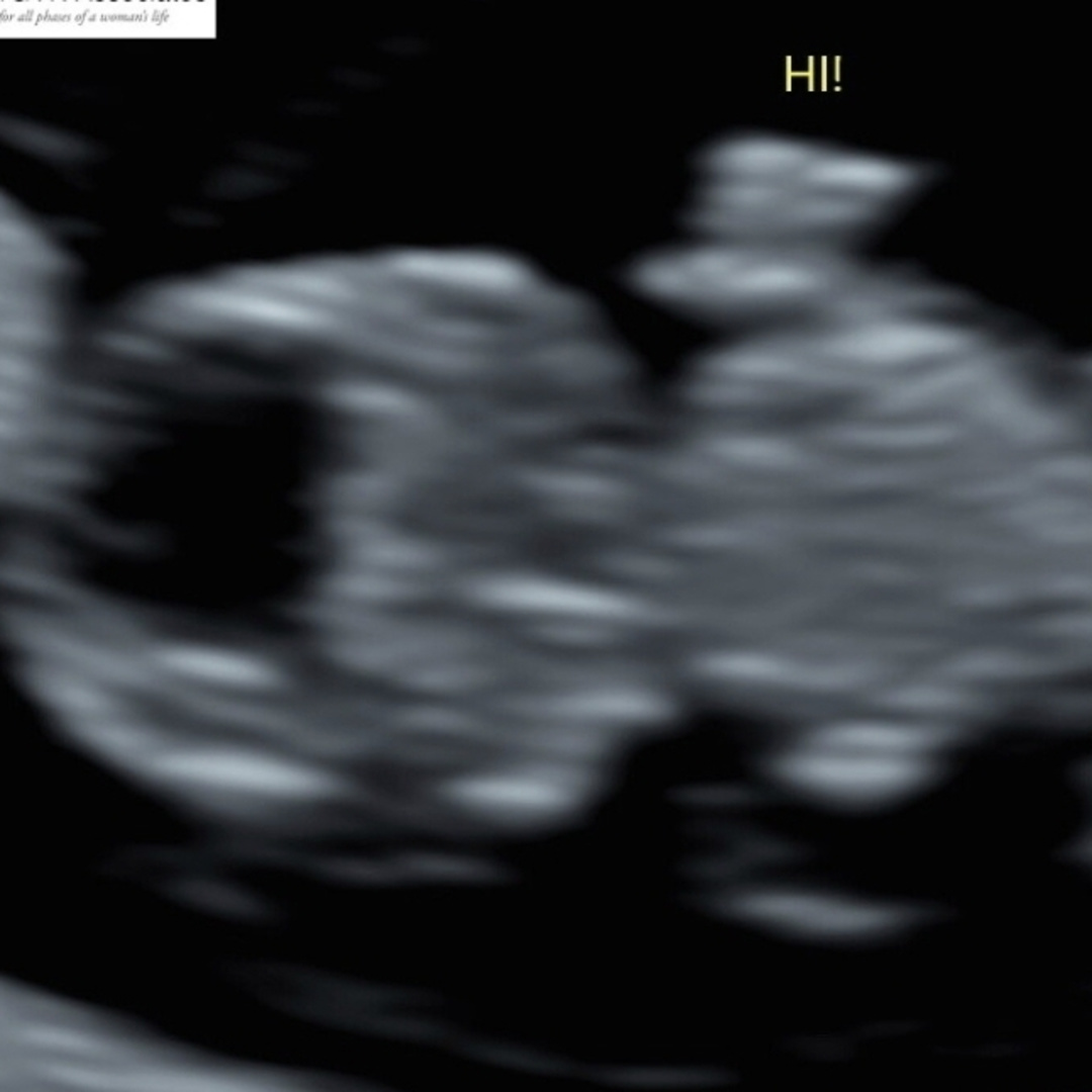 Photo shared by Jacky for their Babylist baby registry.