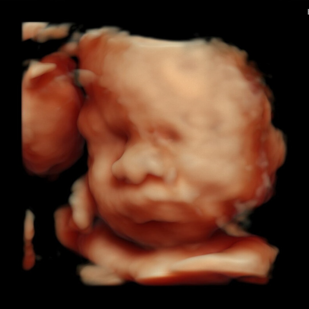 Photo shared by Aaliyah for their Babylist baby registry.