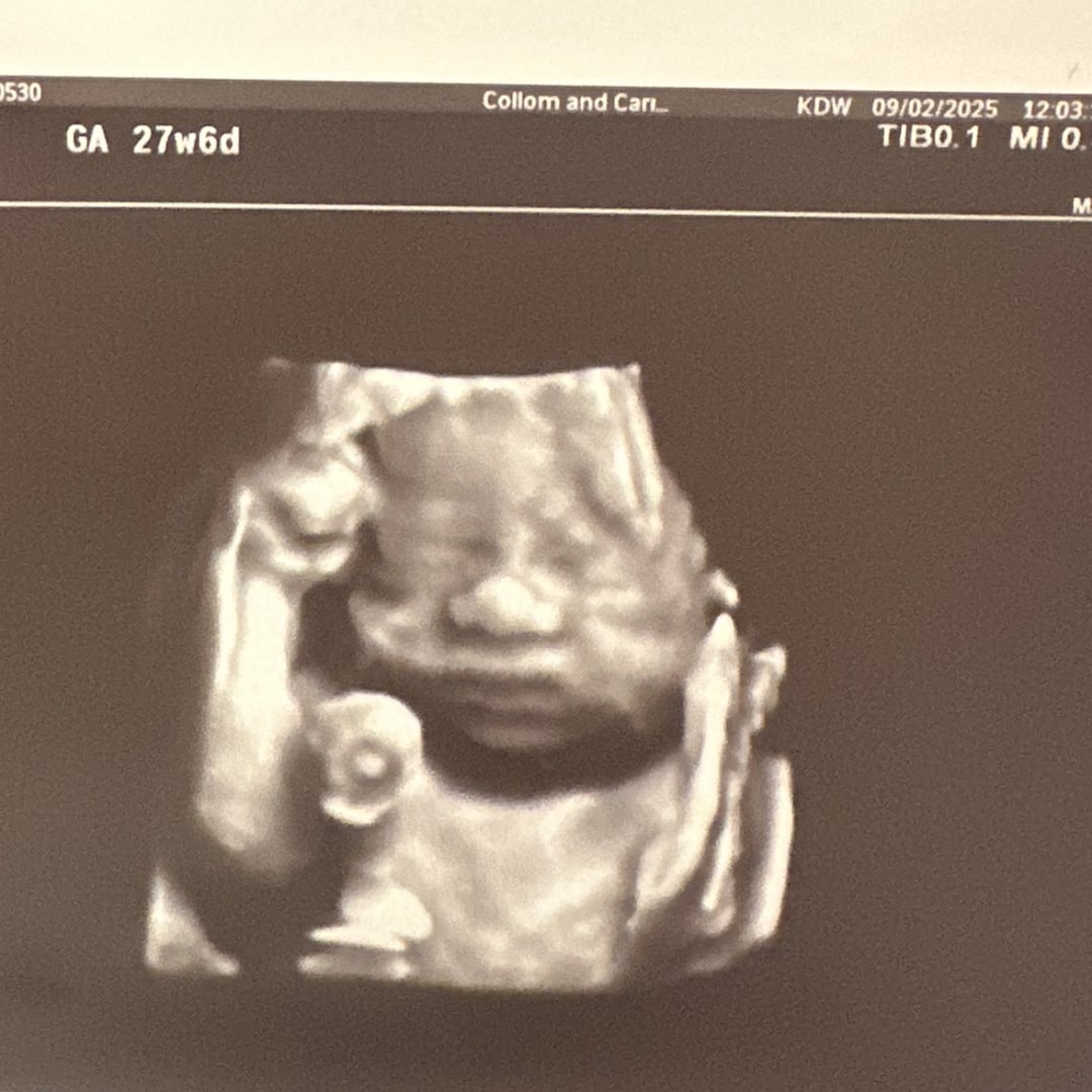 Photo shared by Alex for their Babylist baby registry.
