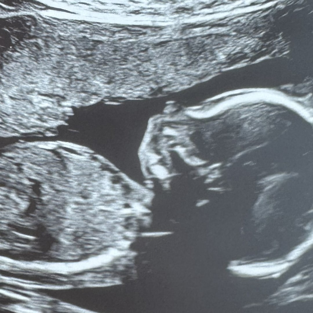 Photo shared by Ashley for their Babylist baby registry.