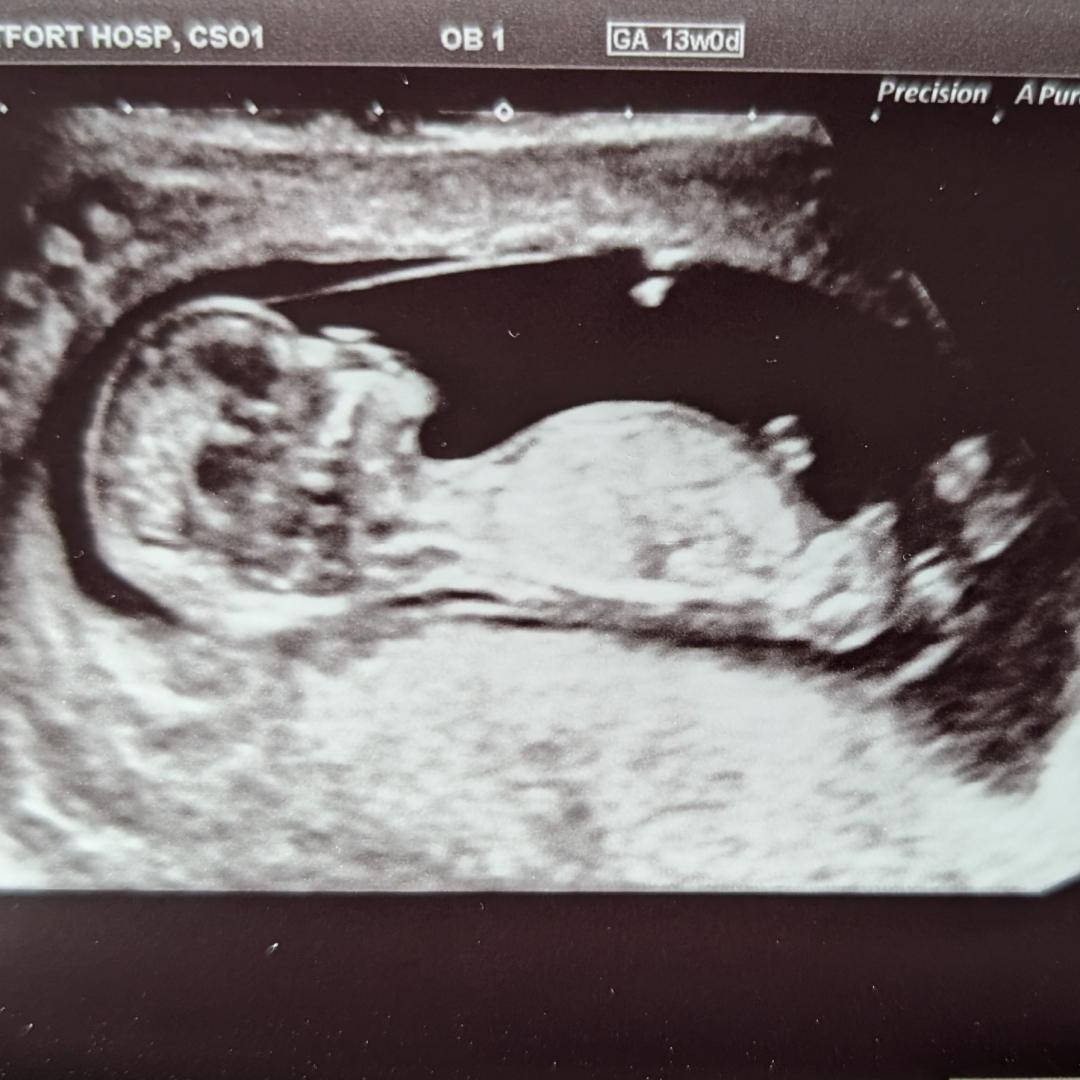 Photo shared by Camille-Emmanuelle for their Babylist baby registry.