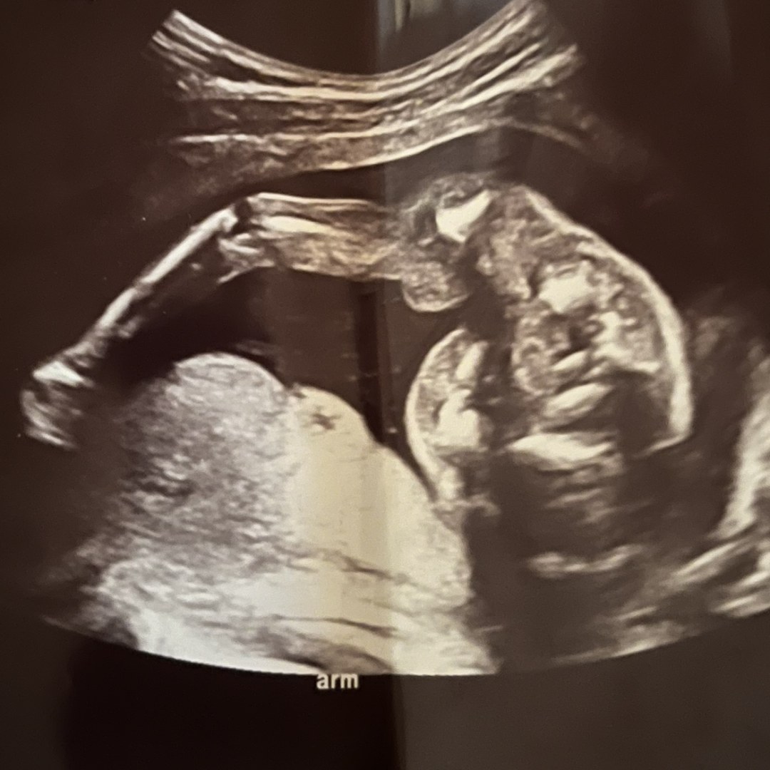 Photo shared by Jaylen for their Babylist baby registry.