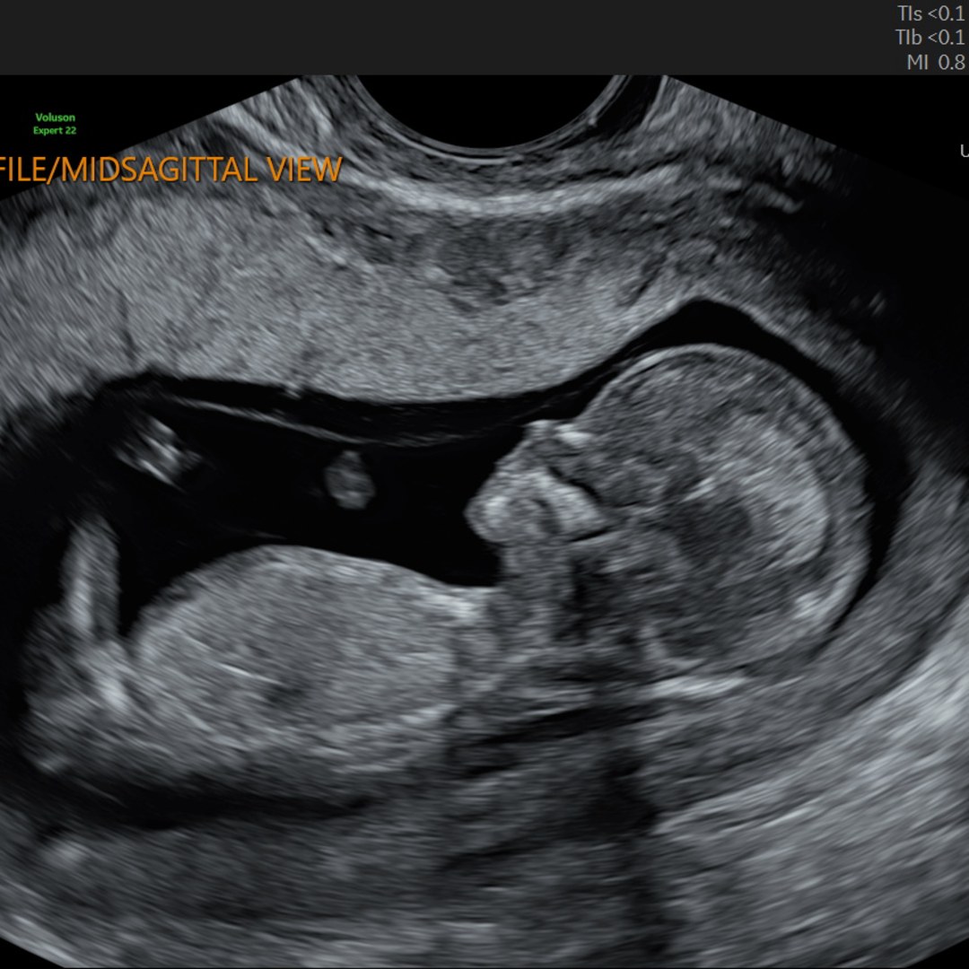 Photo shared by Felicia for their Babylist baby registry.