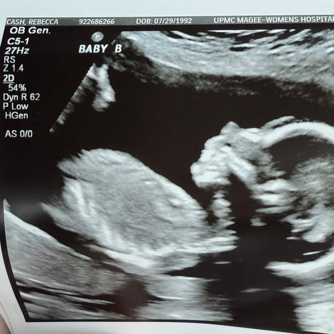 Photo shared by Becca for their Babylist baby registry.