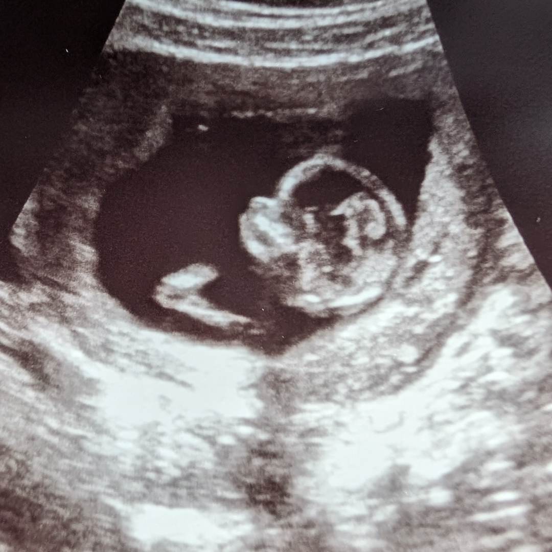 Photo shared by Cassidy for their Babylist baby registry.