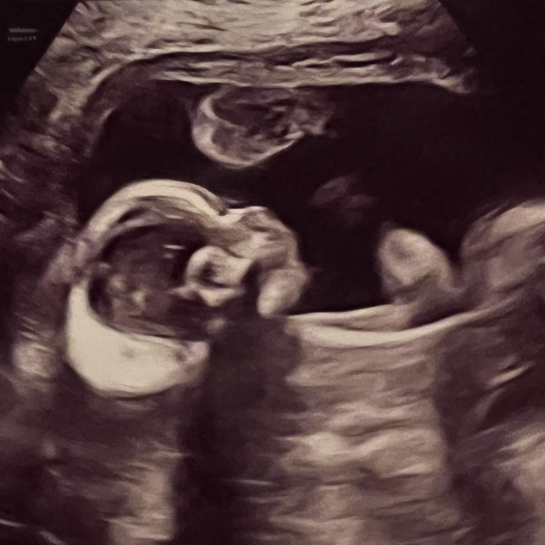 Photo shared by Lauren for their Babylist baby registry.