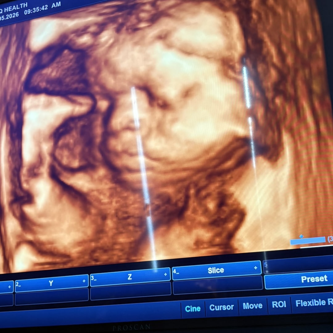 Photo shared by Akeiyla for their Babylist baby registry.