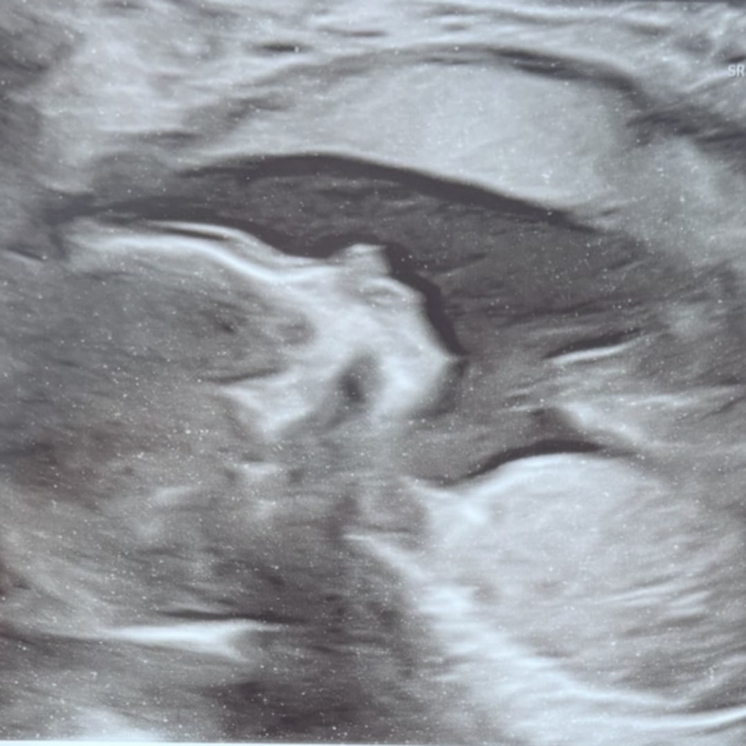 Photo shared by Hannah for their Babylist baby registry.