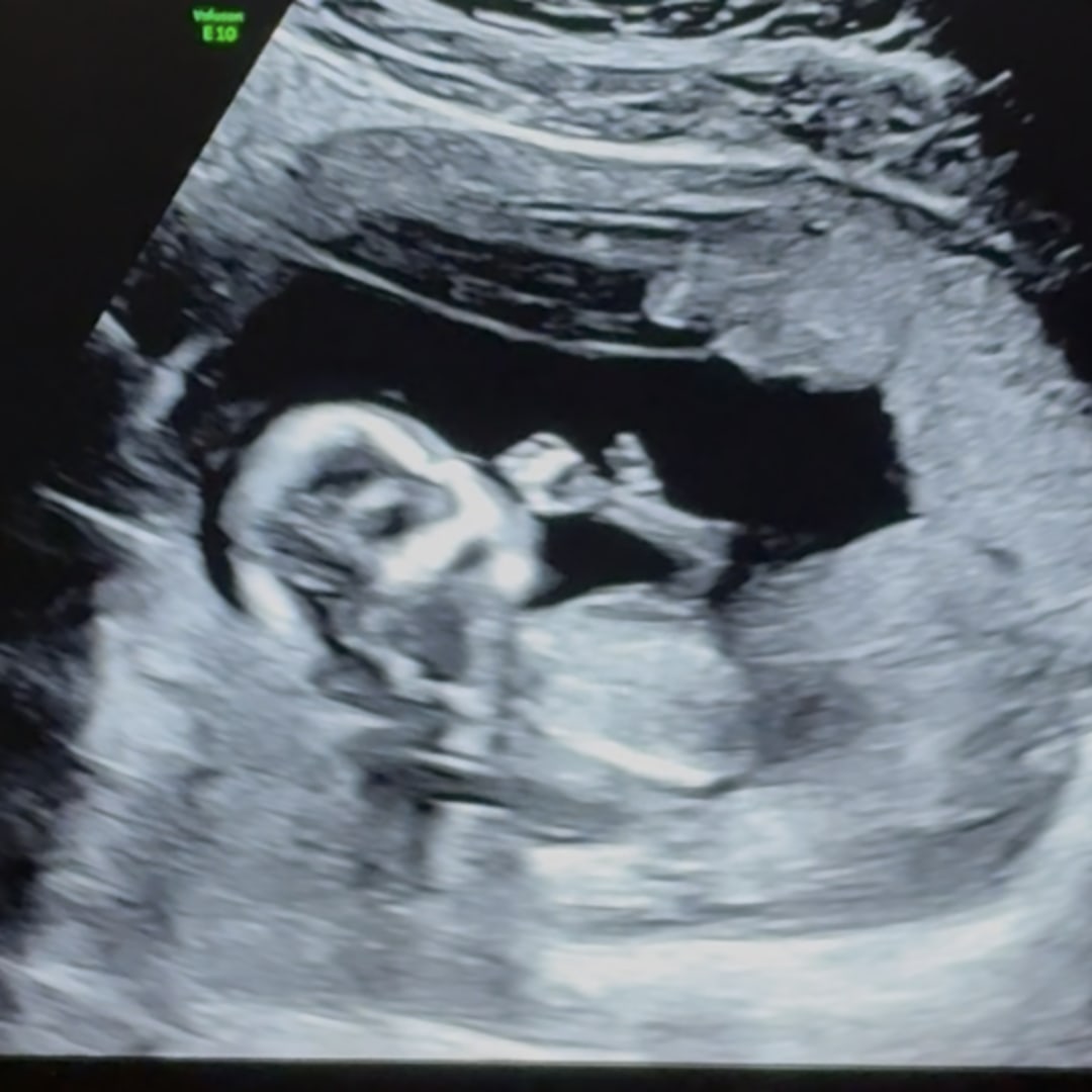 Photo shared by Ashley for their Babylist baby registry.