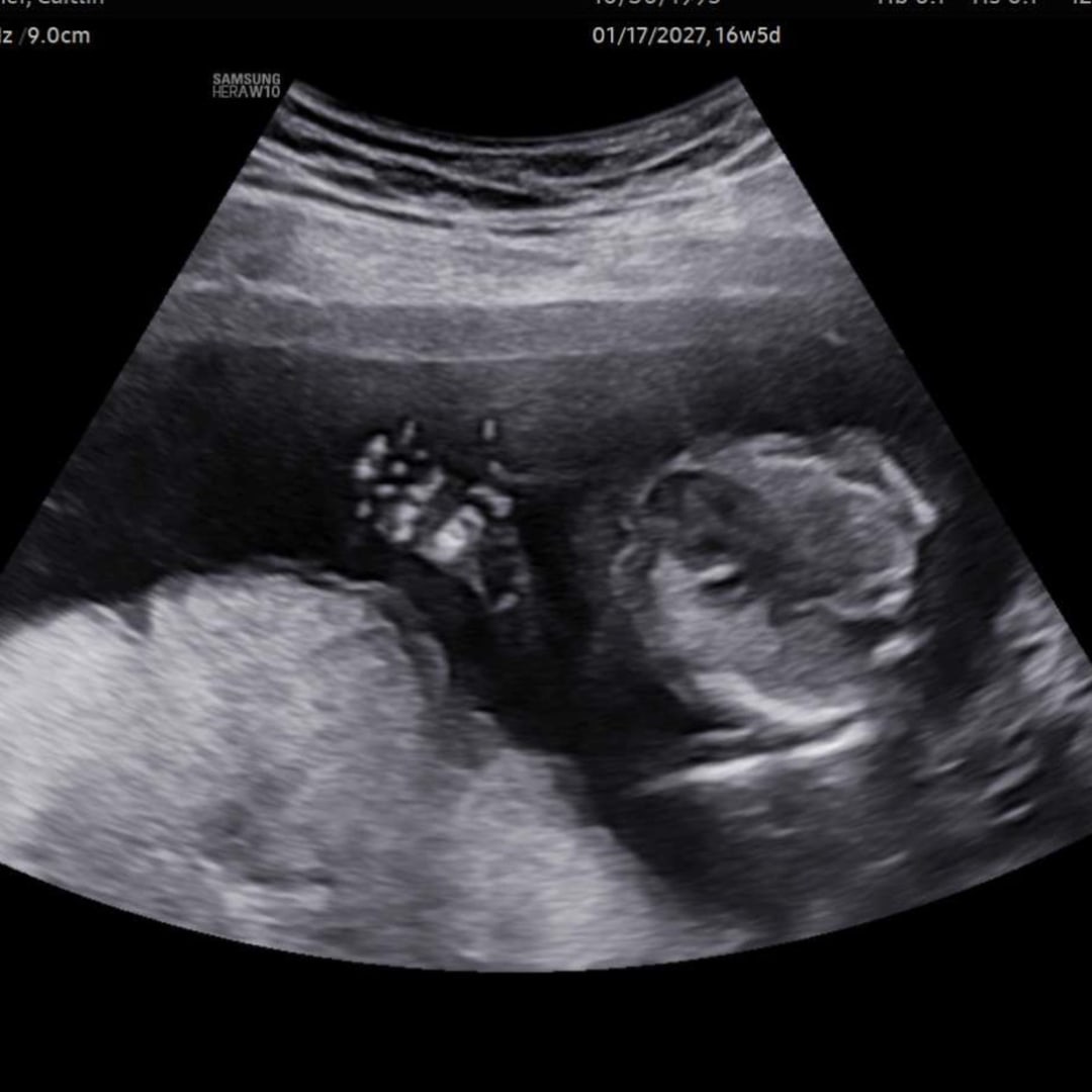 Photo shared by Caitlin for their Babylist baby registry.