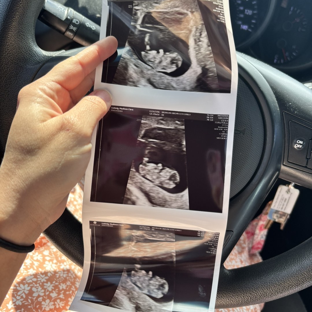 Photo shared by Madison for their Babylist baby registry.