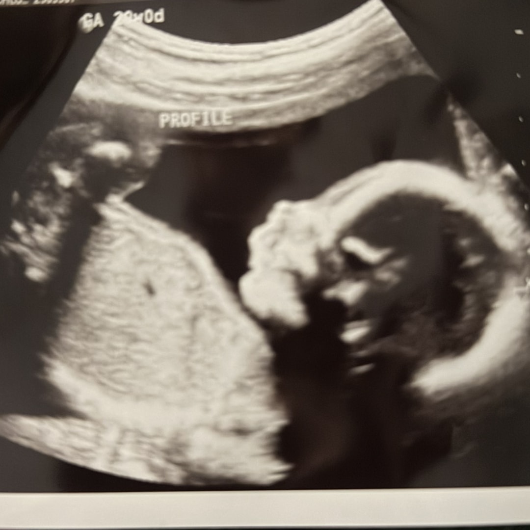 Photo shared by Chloe for their Babylist baby registry.