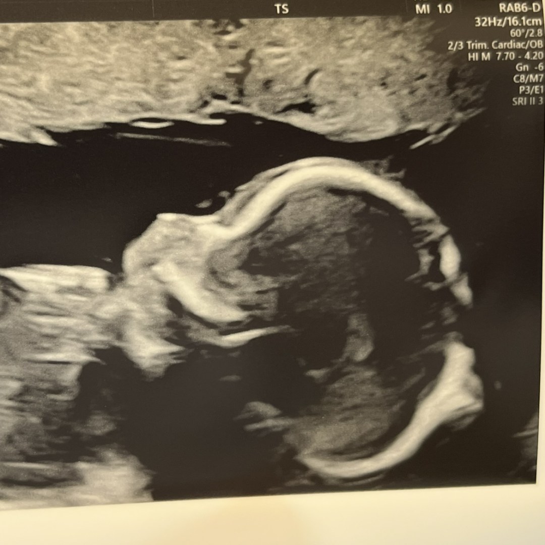 Photo shared by Emily for their Babylist baby registry.